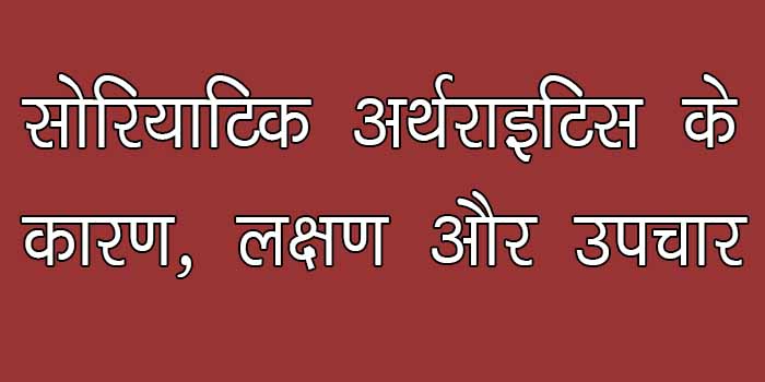 सोरियाटिक अर्थराइटिस के कारण, लक्षण और उपचार